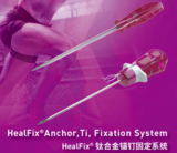 钛合金锚钉固定系统 HealFix Anchor，Ti,Fixation System